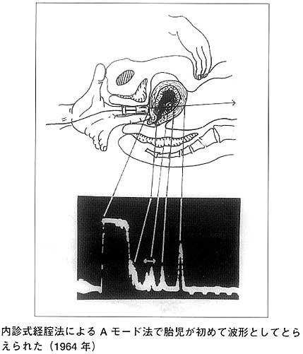 超音波胎児病学／竹内久彌(著者) 医用画像電子博物館 ---JIRA Virtual Museum---